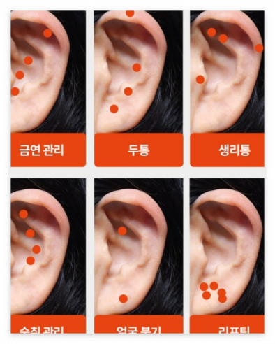 귀이침 다이어트? 혜리 지수 채령이 쓰는 귀침 스티커 붙이는 위치 총정리!