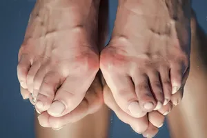 발바닥-통증부위