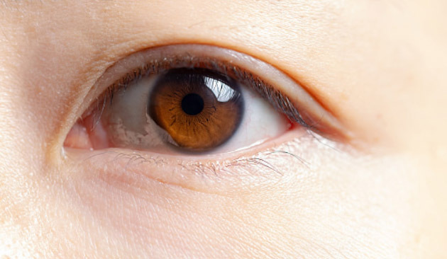 눈에 날파리 현상-병원