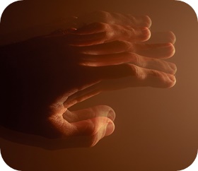 parkinsons