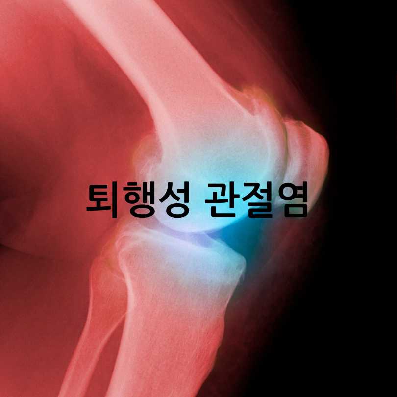 관절영양제