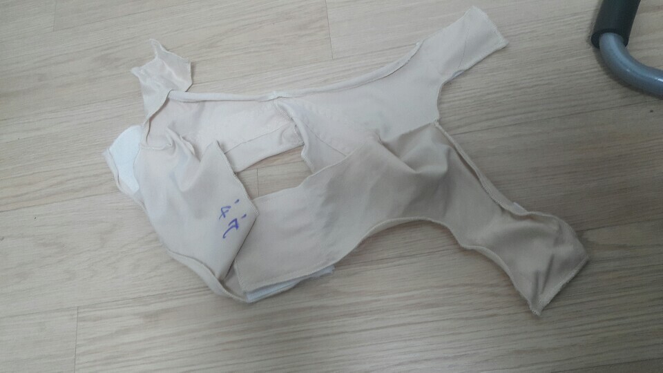 얼굴 지방흡입 후기