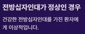 전방십자인대 보존형 무릎 부분치환술 - 전방십자인대가 정상인 경우
