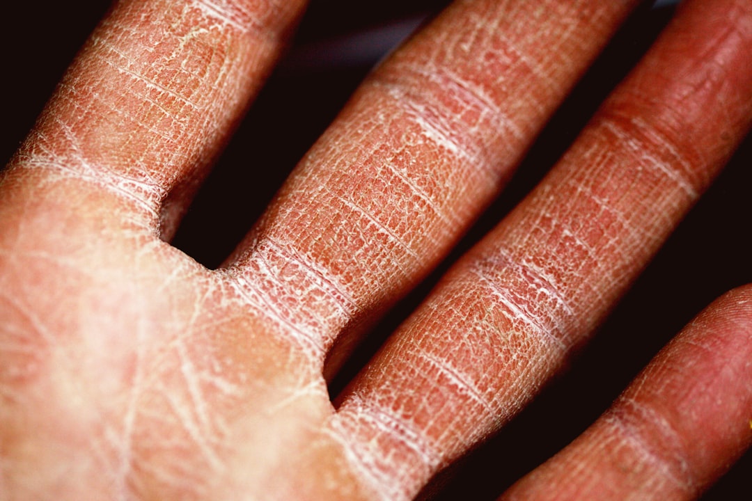 Dermatology