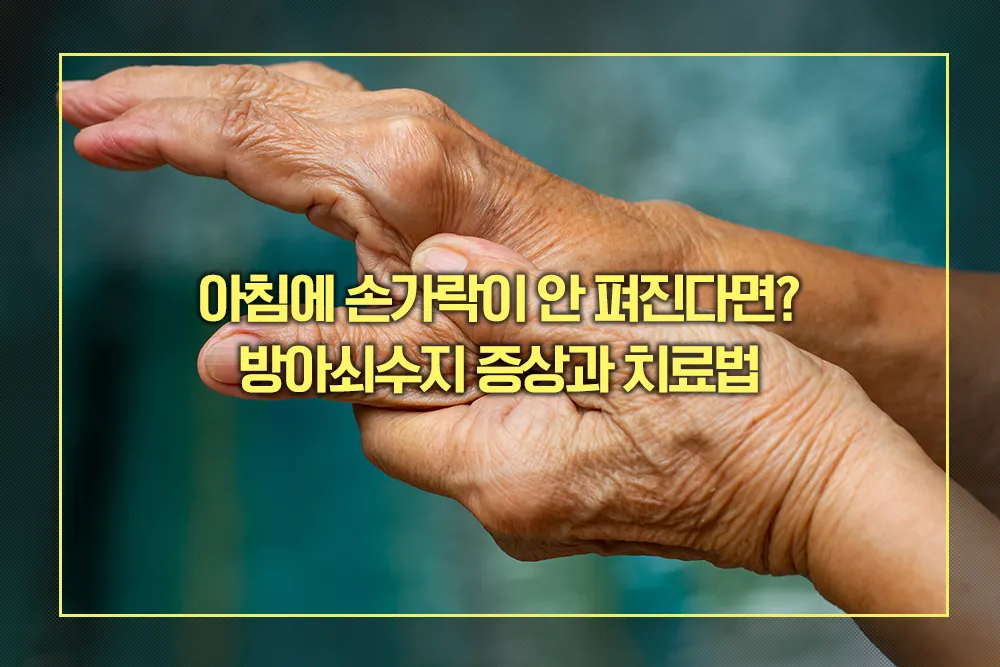 방아쇠수지 증상과 치료법