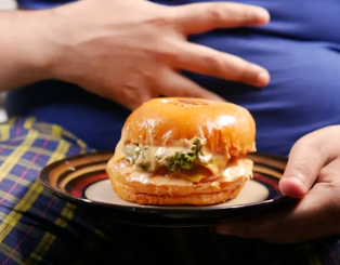 비만 치료 방법 진단기준 예방법