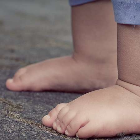 하지정맥류 증상