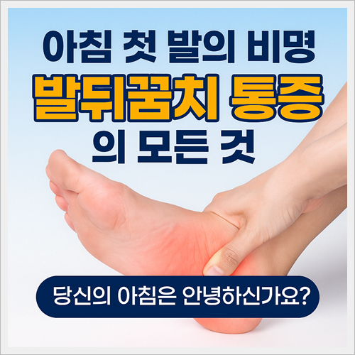 족저근막염 통증 썸네일입니다.