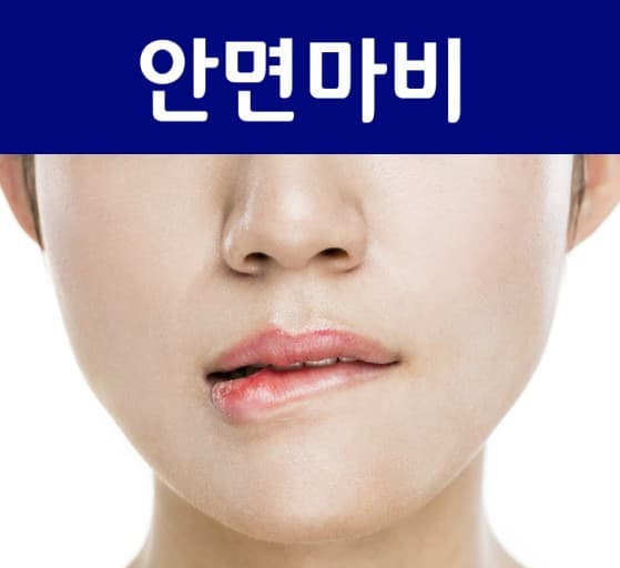 구안와사 증상