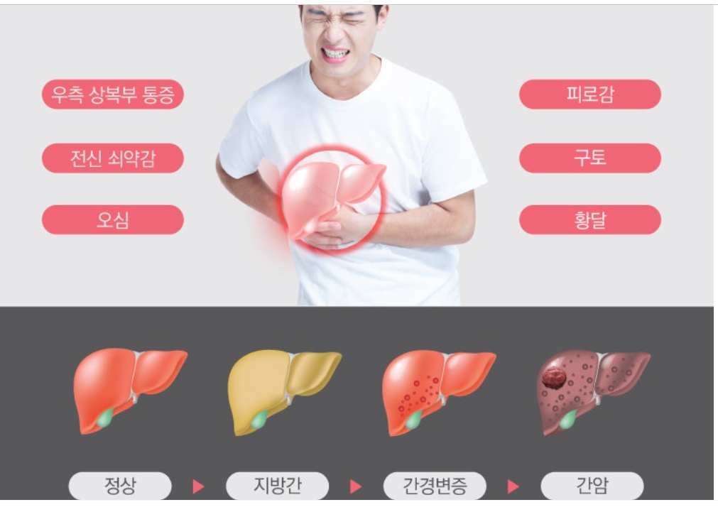 지방간 증상