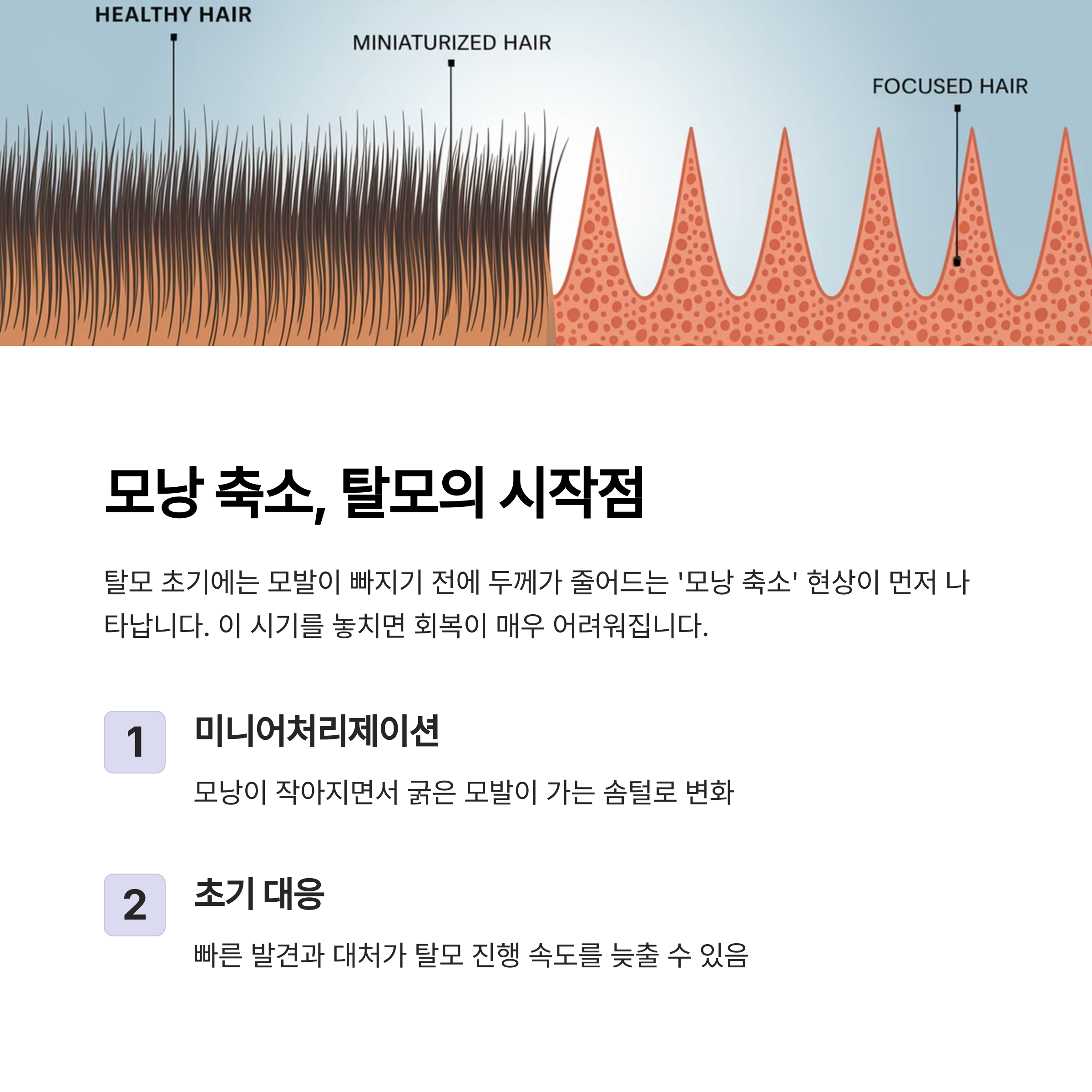 머리 두피 확대 이미지