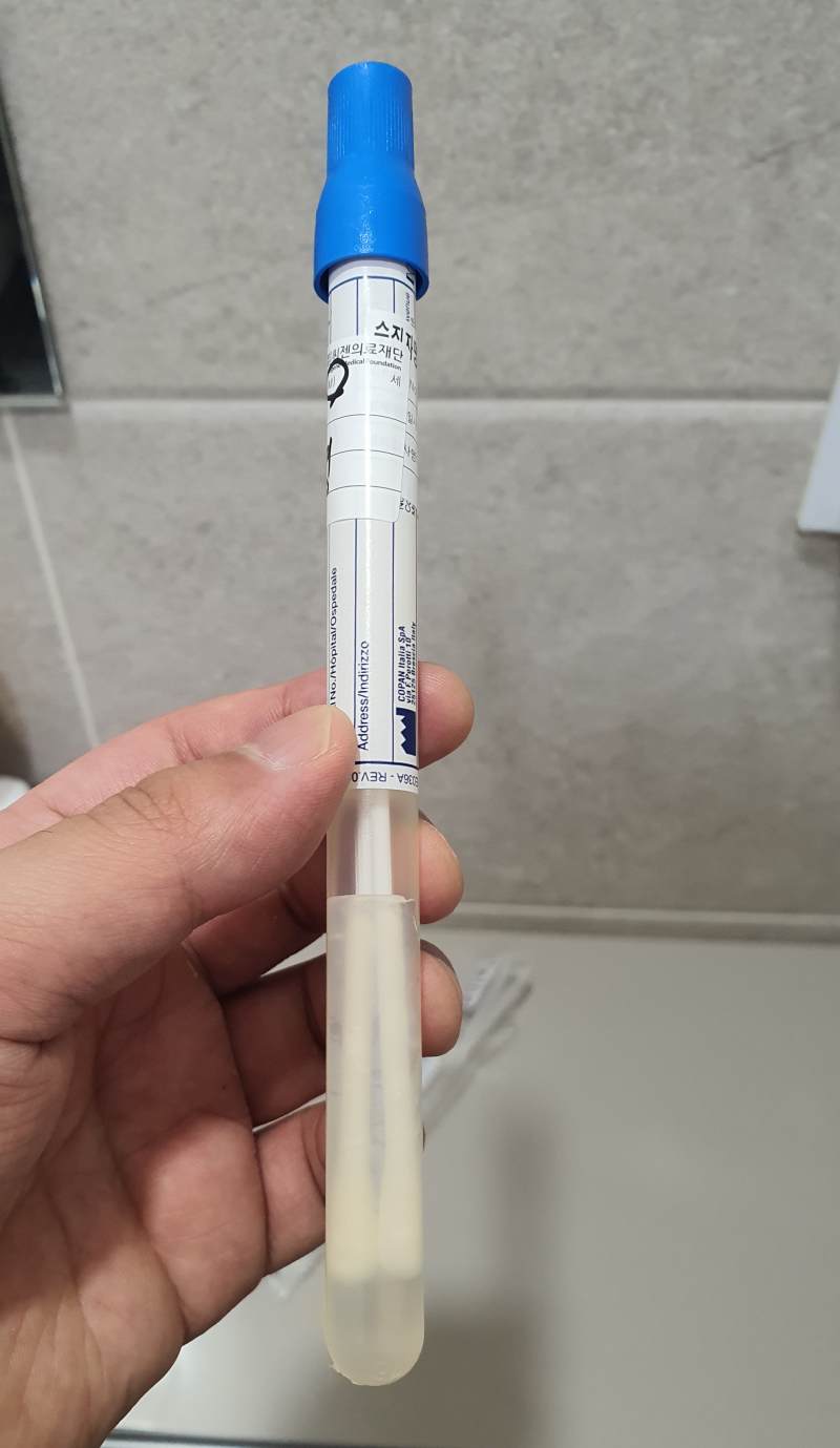 항문검사-후-기구