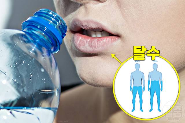 뇌경색 여름철 질병 여름질병 탈수 증상