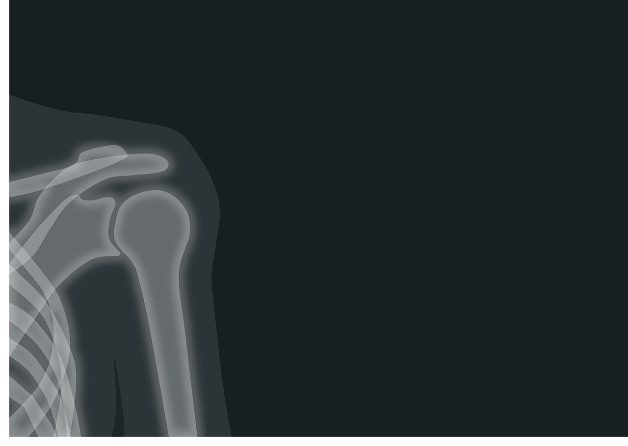 어깨 통증, 어깨 석회성 건염, 어깨 건염, 어깨 석회성, 석회성, 어깨 관절, 어깨 근육, 어깨 운동