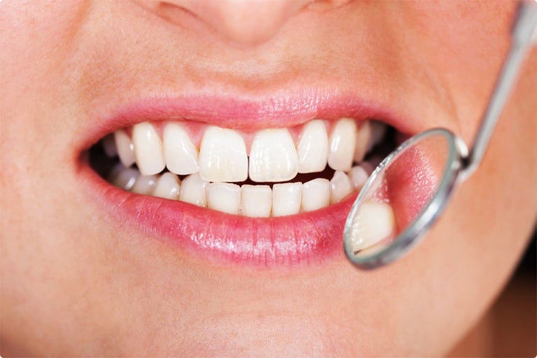 오라씨엠유 가격 오라덴티 구강유산균