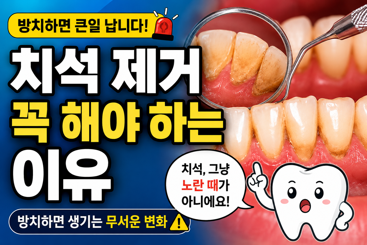 치석 제거 꼭 해야 하는 이유
