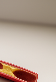 허혈성 심장질환