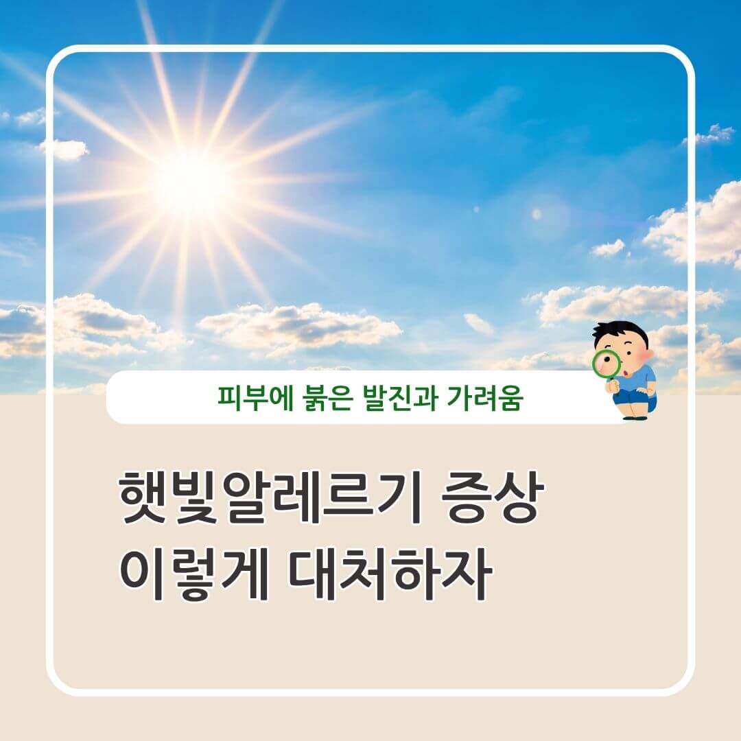 햇빛알레르기증상
