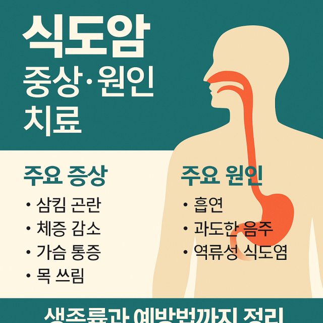 식도암의 주요 증상과 원인, 치료 방법 및 생존율을 종합적으로 정리한 대표 이미지로, 조기 발견과 치료 전략의 중요성을 강조합니다