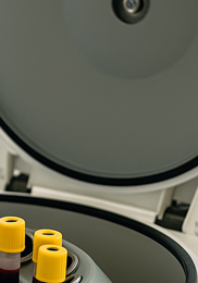 콜레스테롤 정상수치