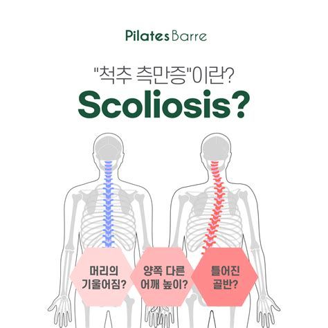 척추측만증 교정운동