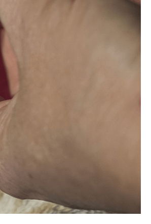 손가락마디통증