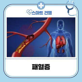 패혈증이란 무엇인지 원인 증상 치료 예방법_7
