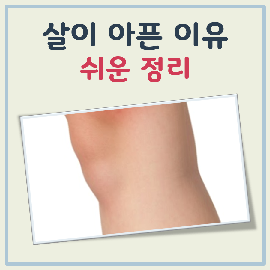 살이 아픈이유 대표 이미지