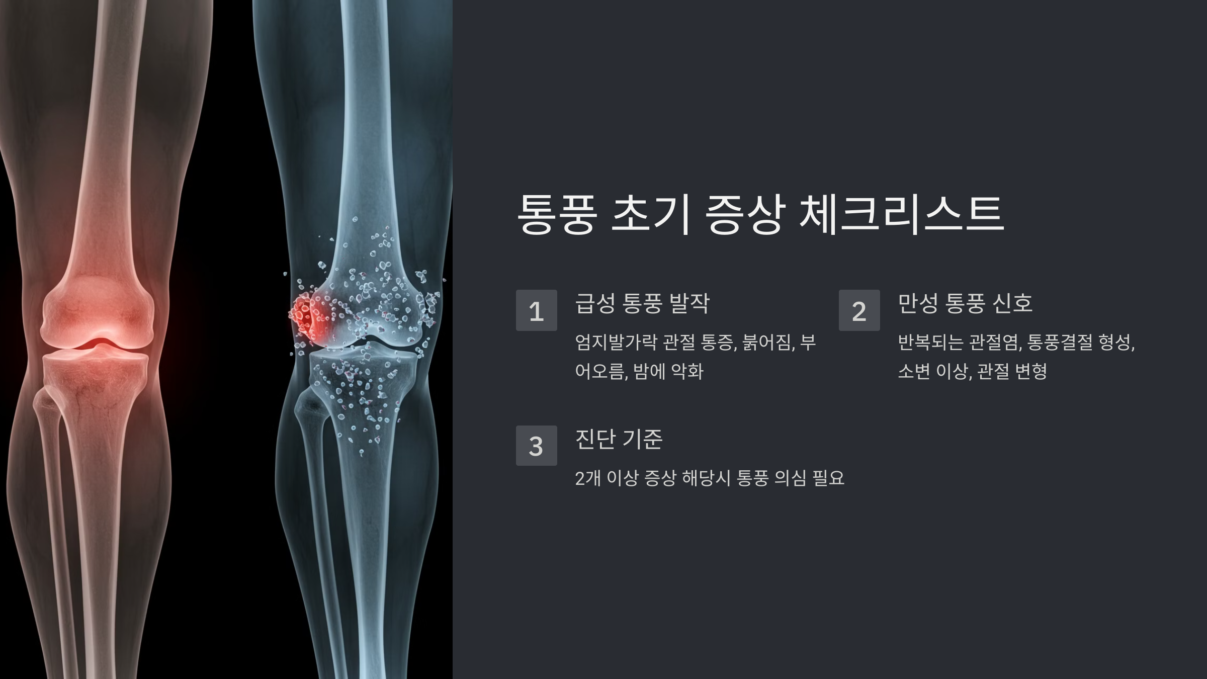 통풍 초기 증상 체크리스트 관련 이미지