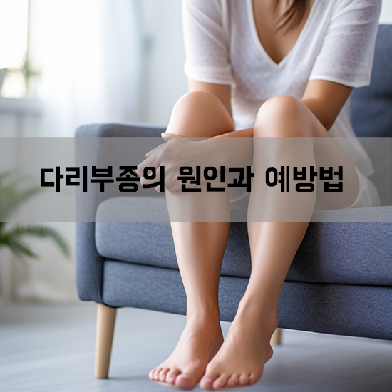 다리부종의 원인과 예방법