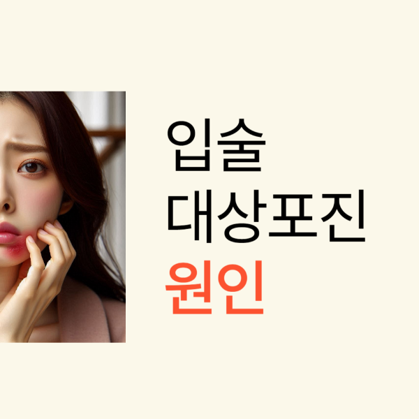대상포진