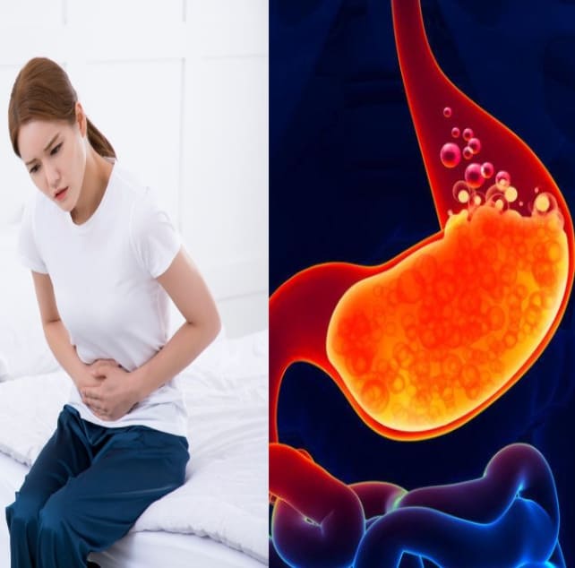 여성이 배를 움켜쥐고 역류성 식도염증 위 이미지