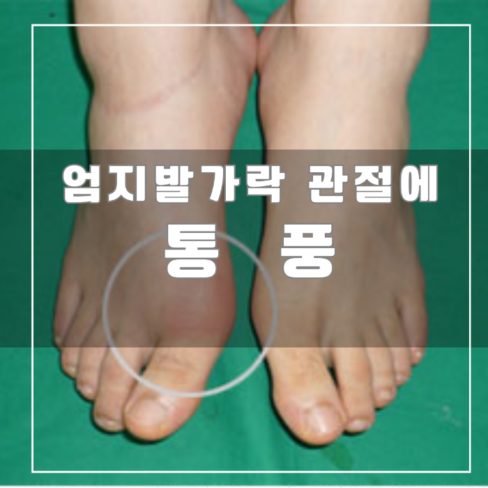 통품