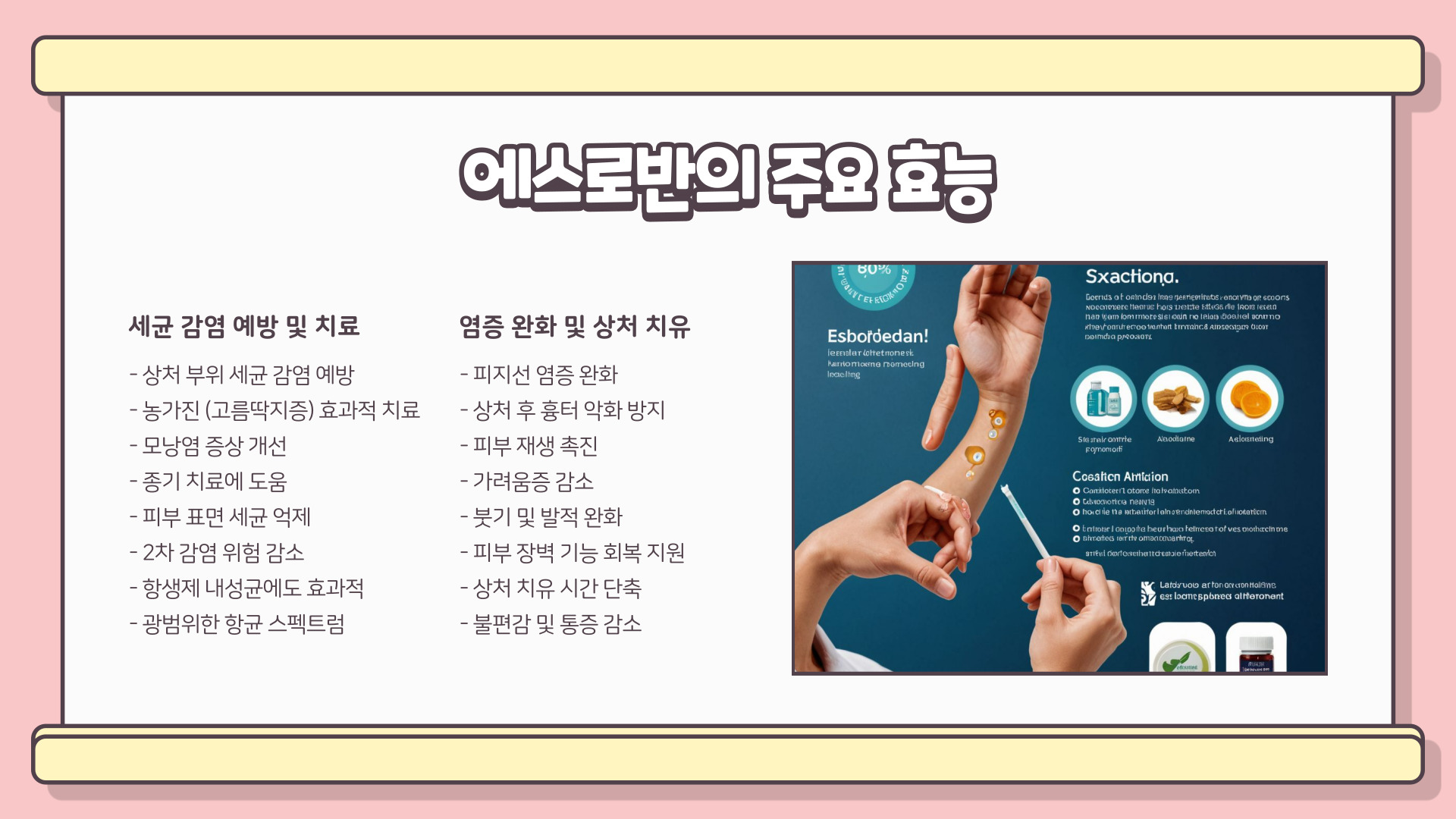 에스로반 연고 효능