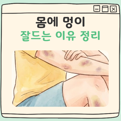 몸에 멍이 잘드는 이유 대표 이미지