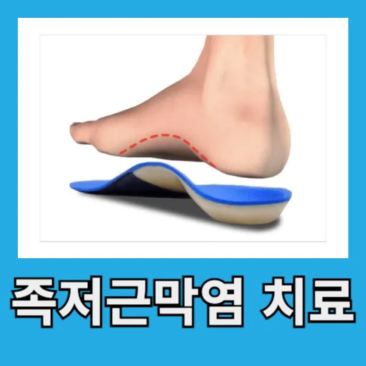 족저근막염 치료