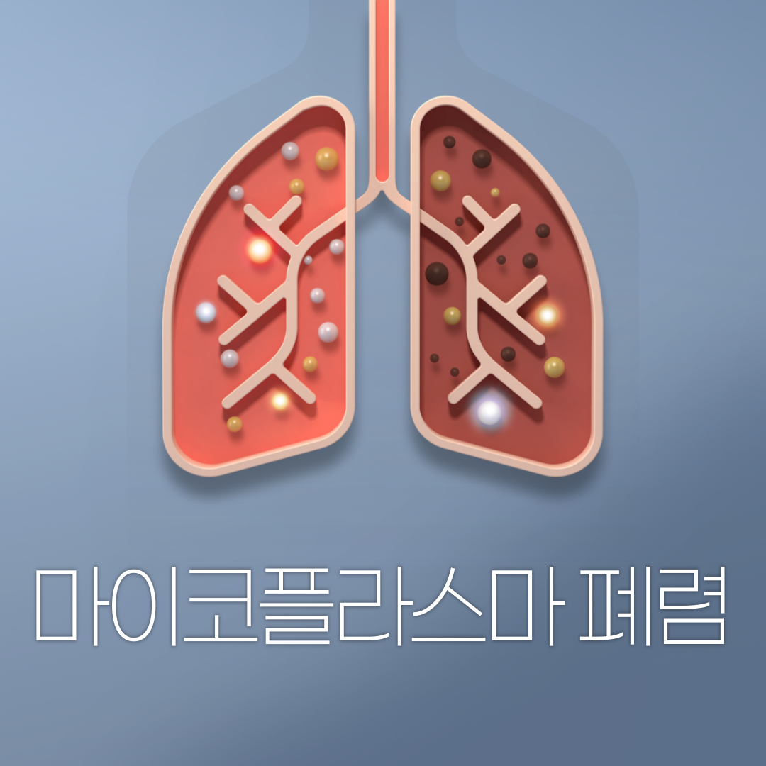 마이코플라스마 폐렴