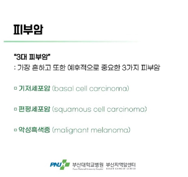 피부암-종류-3가지