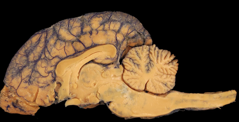 뇌 해부의 모습
