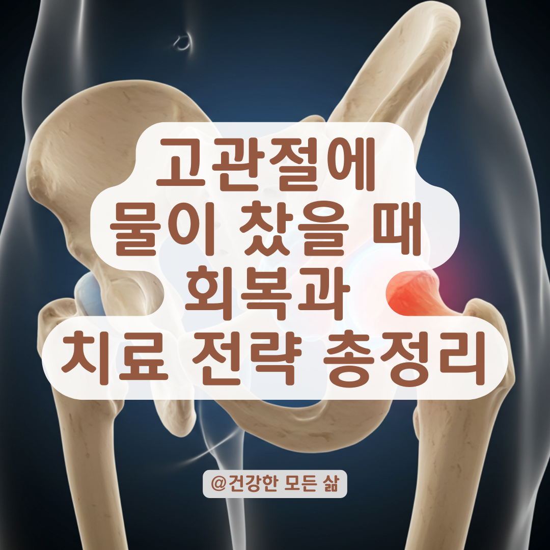 고관절에 물이 찼을 때 회복 기간과 치료 선택 가이드 .