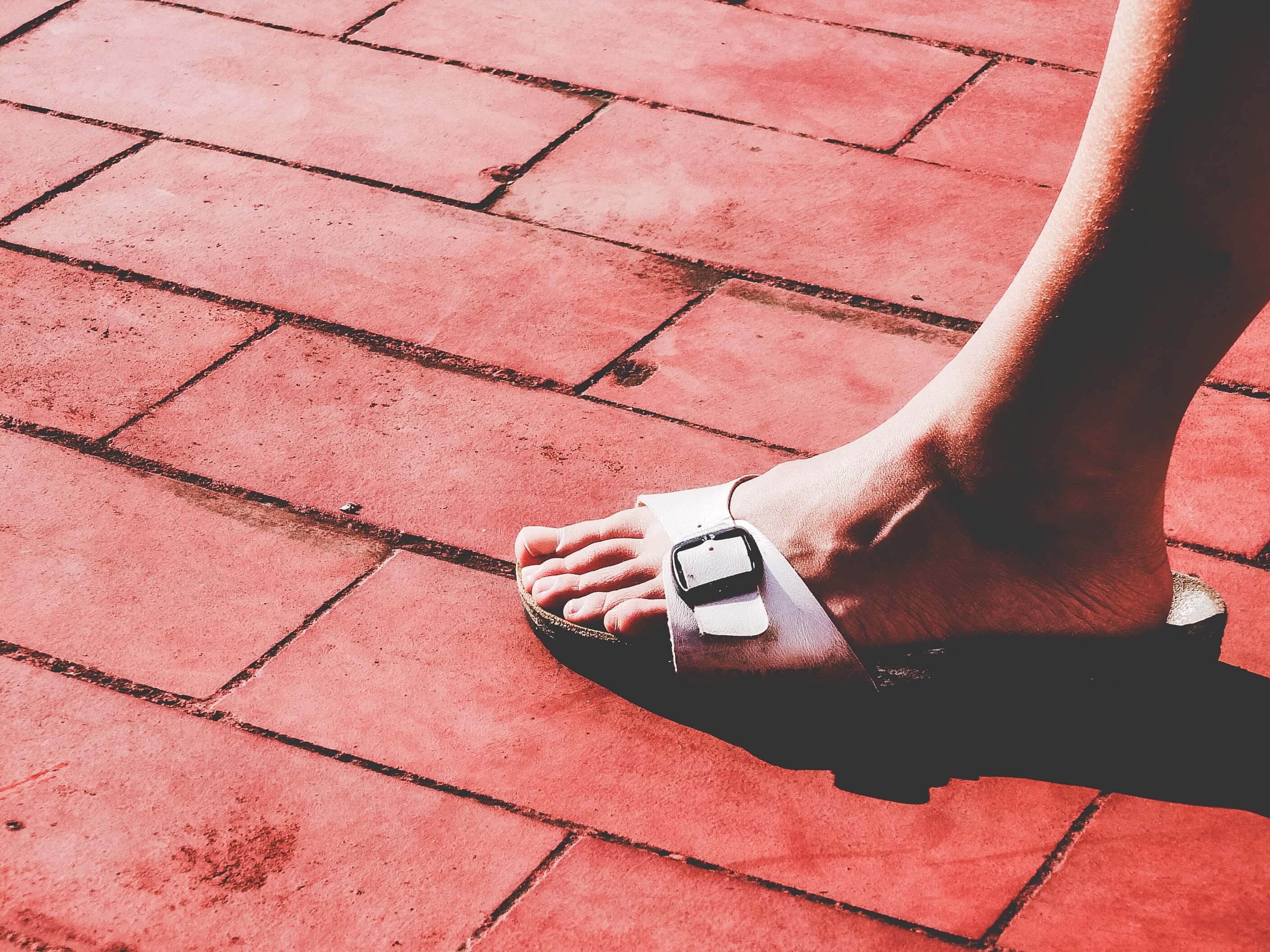 물집 생겼을 때