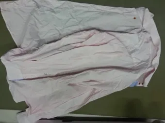 이염 제거 산소계표백제 테스트와 국소 세척 순서_25