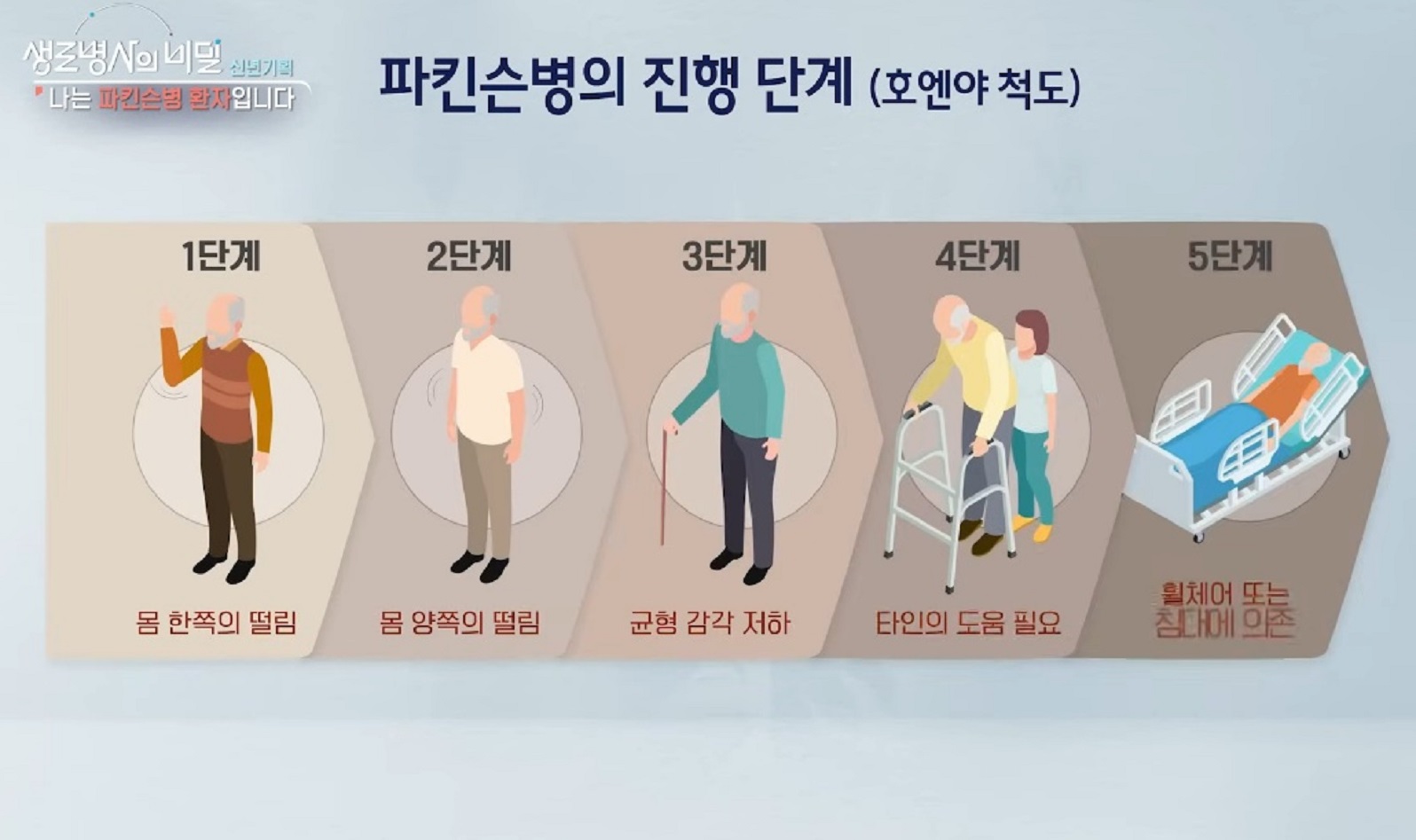 파킨슨병-진행-단계