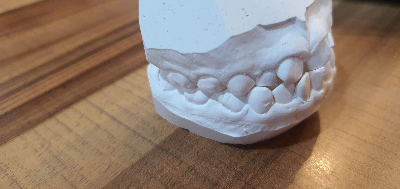 교정 결과 상담