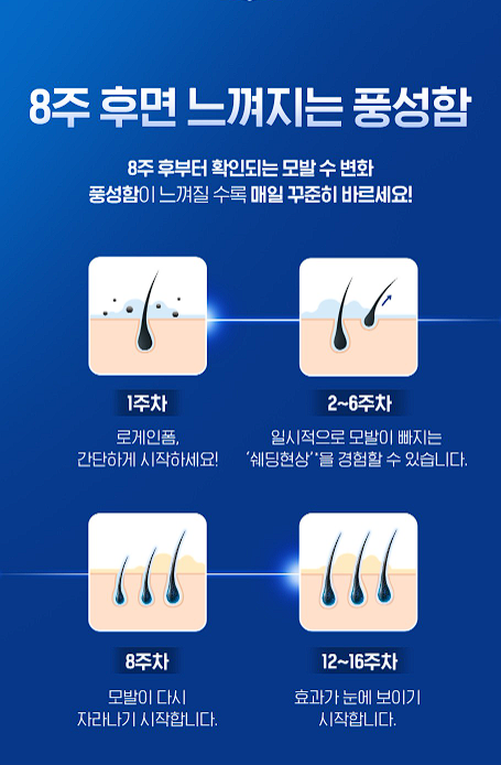 로게인폼 가격 후기