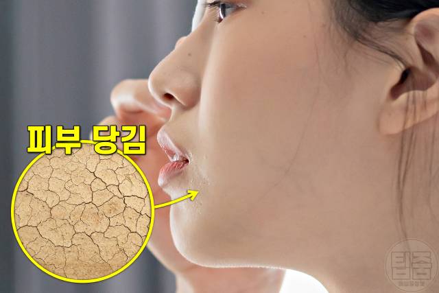 얼굴 노화 증상,피부노화 증상,피부 당김