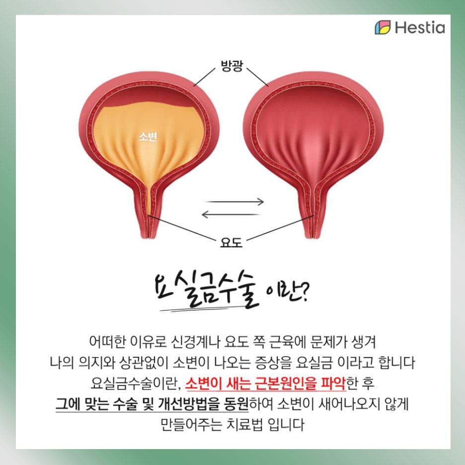요실금수술
요실금증상 요실금실비