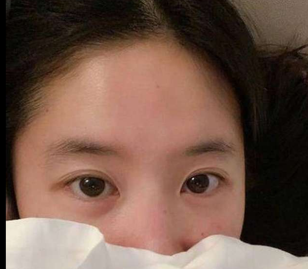 쏙빼스톤 효과