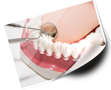 임플란트 가격 특징 정리