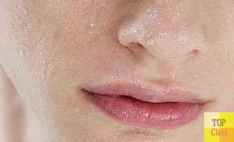 피부각질 제거로 생기는 이점